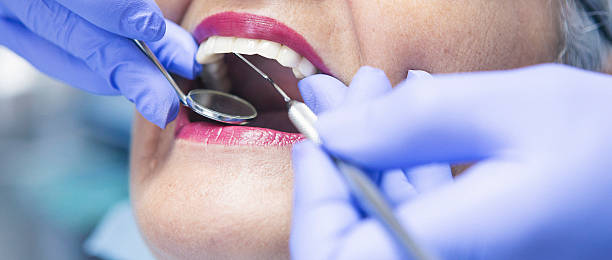 Best Emergency Wisdom Teeth Removal in , VT